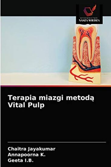 Terapia miazgi metoda Vital Pulp