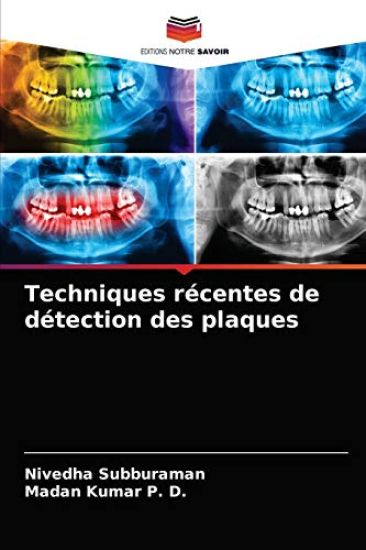Techniques récentes de détection des plaques