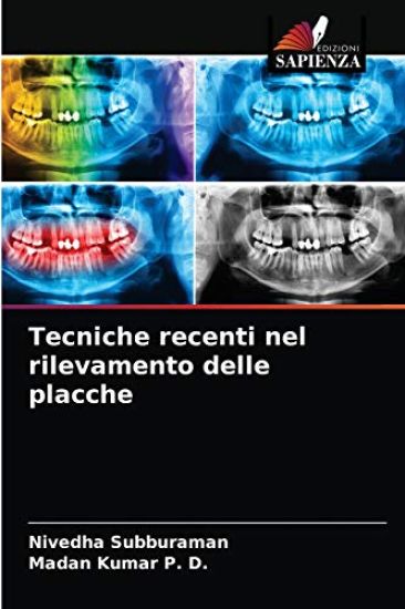 Tecniche recenti nel rilevamento delle placche