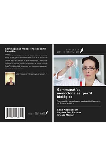 Gammapatías monoclonales: perfil biológico