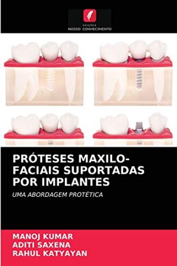Próteses Maxilo-Faciais Suportadas Por Implantes