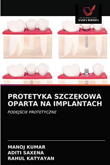 Protetyka SzczEkowa Oparta Na Implantach