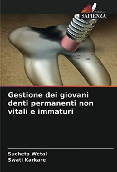 Gestione dei giovani denti permanenti non vitali e immaturi