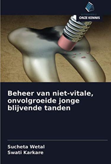 Beheer van niet-vitale, onvolgroeide jonge blijvende tanden