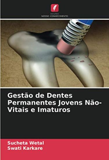 Gestão de Dentes Permanentes Jovens Não-Vitais e Imaturos