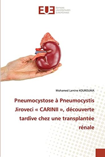 Pneumocystose à Pneumocystis Jiroveci CARINII, découverte tardive chez une transplantée rénale