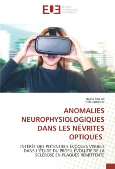 ANOMALIES NEUROPHYSIOLOGIQUES DANS LES NÉVRITES OPTIQUES