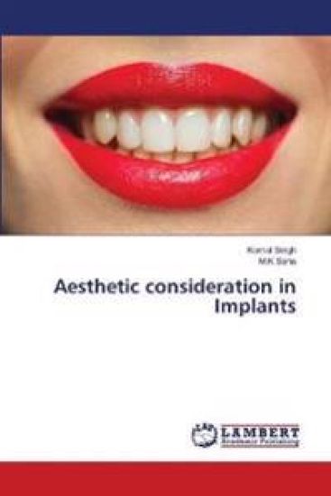 Aesthetic consideration in Implants