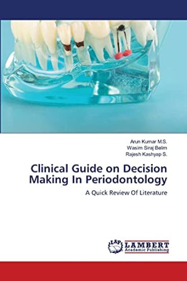 Clinical Guide on Decision Making In Periodontology