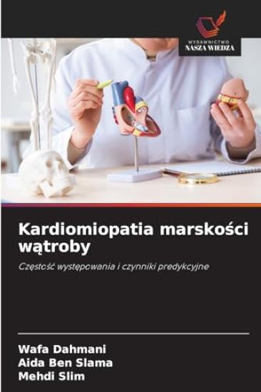 Kardiomiopatia marskosci watroby
