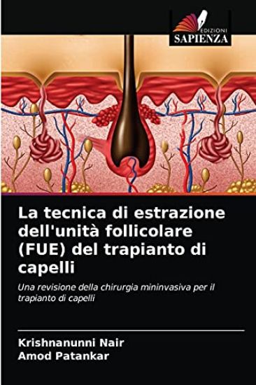 La tecnica di estrazione dell'unità follicolare (FUE) del trapianto di capelli