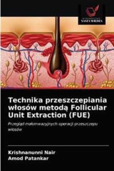 Technika przeszczepiania wlosów metoda Follicular Unit Extraction (FUE)
