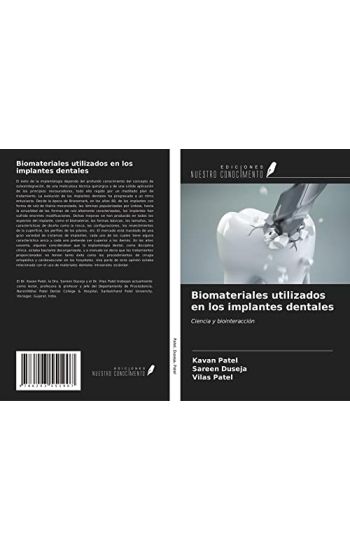 Biomateriales utilizados en los implantes dentales