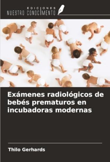 Exámenes radiológicos de bebés prematuros en incubadoras modernas