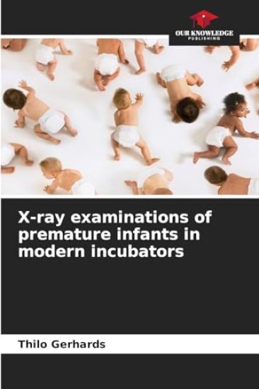 X-ray examinations of premature infants in modern incubators