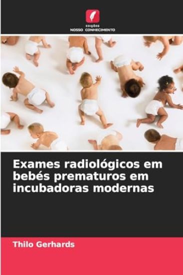Exames radiológicos em bebés prematuros em incubadoras modernas