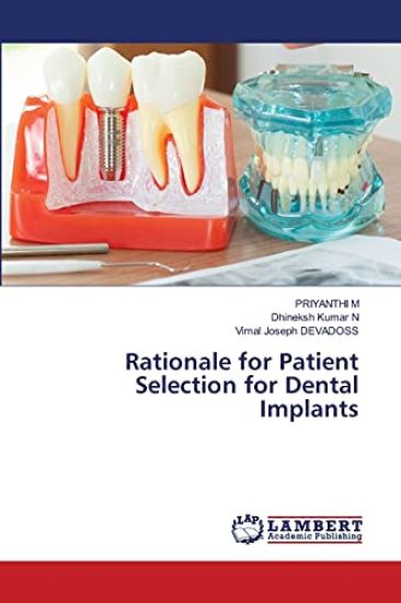 Rationale for Patient Selection for Dental Implants