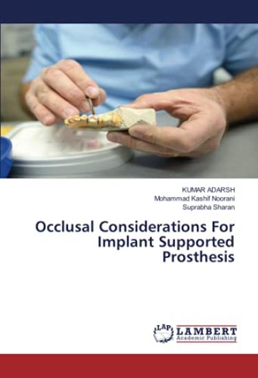 Occlusal Considerations For Implant Supported Prosthesis