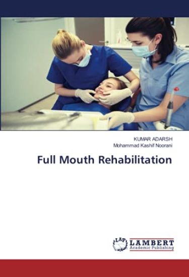 Full Mouth Rehabilitation