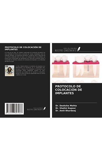PROTOCOLO DE COLOCACIÓN DE IMPLANTES