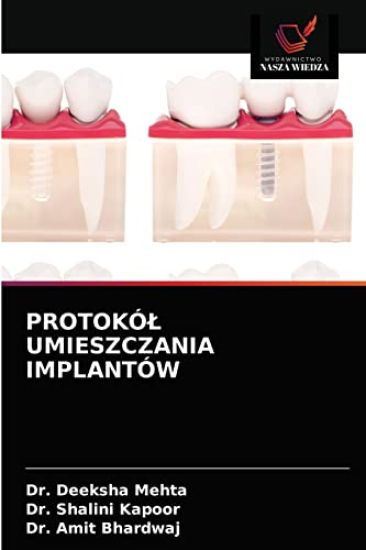Protokól Umieszczania Implantów