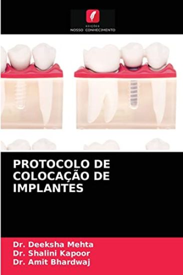 Protocolo de Colocação de Implantes