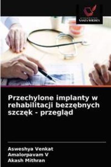 Przechylone implanty w rehabilitacji bezzebnych szczek - przeglad
