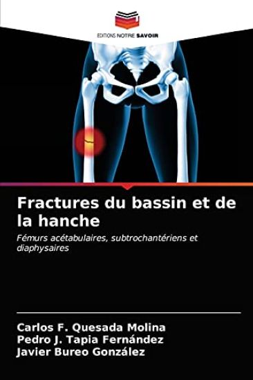 Fractures du bassin et de la hanche