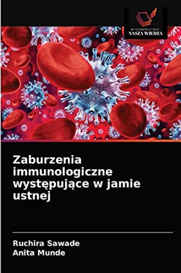 Zaburzenia immunologiczne wystepujace w jamie ustnej