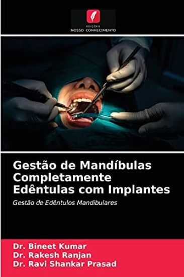 Gestão de Mandíbulas Completamente Edêntulas com Implantes