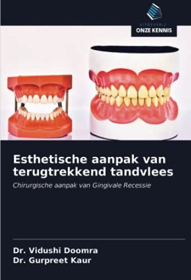 Esthetische aanpak van terugtrekkend tandvlees