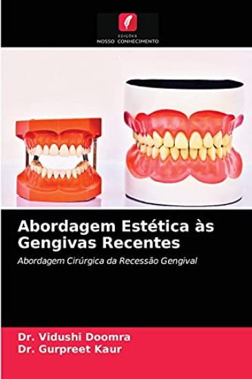 Abordagem Estética às Gengivas Recentes