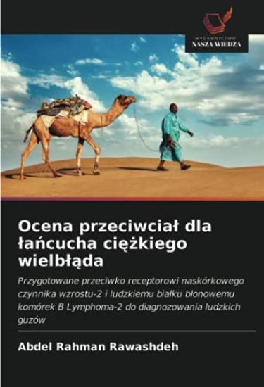 Ocena przeciwcia¿ dla ¿a¿cucha ci¿¿kiego wielb¿¿da