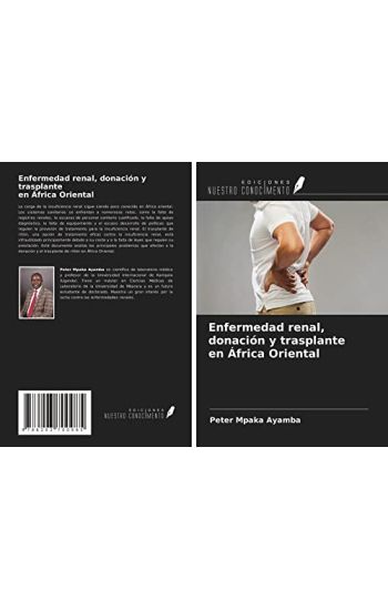 Enfermedad renal, donación y trasplante en África Oriental