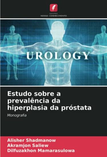 Estudo sobre a prevalência da hiperplasia da próstata