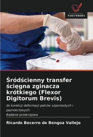 ¿ród¿cienny transfer ¿ci¿gna zginacza krótkiego (Flexor Digitorum Brevis)