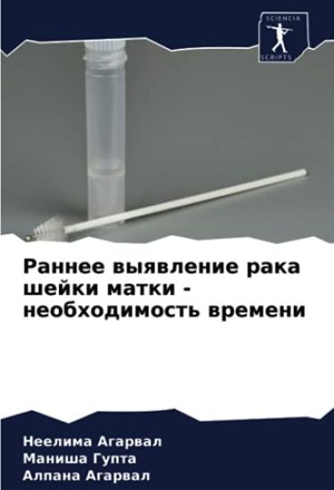 Rannee wyqwlenie raka shejki matki - neobhodimost' wremeni