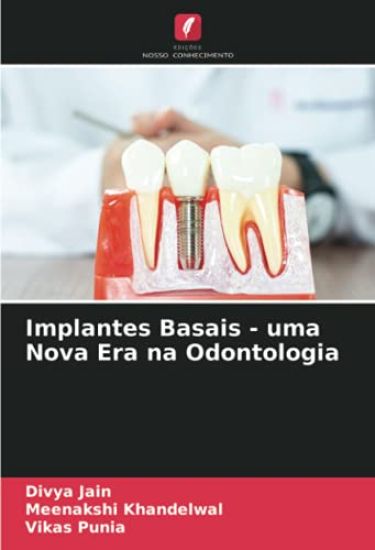 Implantes Basais - uma Nova Era na Odontologia