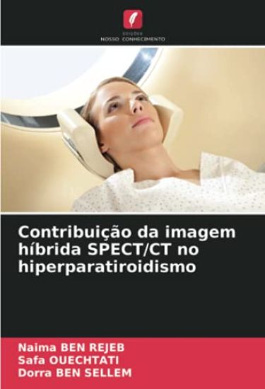 Contribuição da imagem híbrida SPECT/CT no hiperparatiroidismo