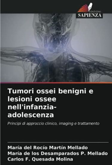 Tumori ossei benigni e lesioni ossee nell'infanzia-adolescenza