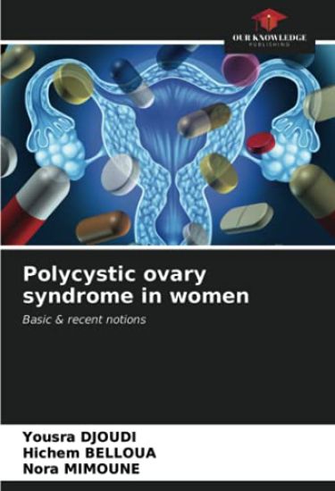 Polycystic ovary syndrome in women