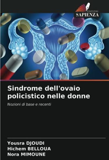 Sindrome dell'ovaio policistico nelle donne
