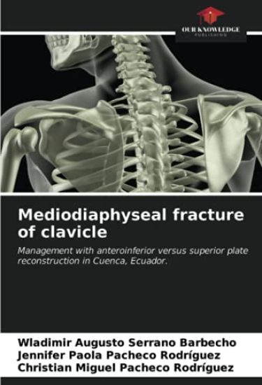Mediodiaphyseal fracture of clavicle