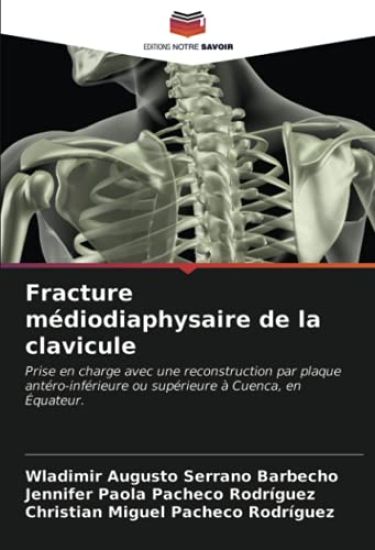 Fracture médiodiaphysaire de la clavicule