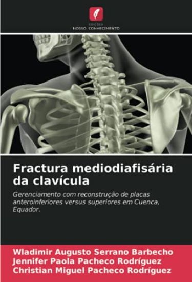 Fractura mediodiafisária da clavícula