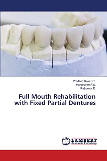 Full Mouth Rehabilitation with Fixed Partial Dentures