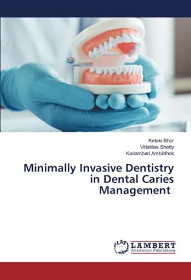 Minimally Invasive Dentistry in Dental Caries Management