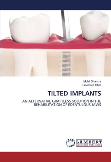 Tilted Implants