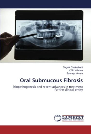 Oral Submucous Fibrosis
