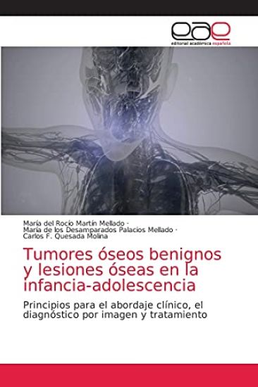 Tumores óseos benignos y lesiones óseas en la infancia-adolescencia